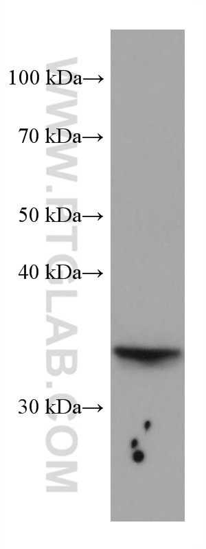 WB analysis of A549 using 67635-1-Ig