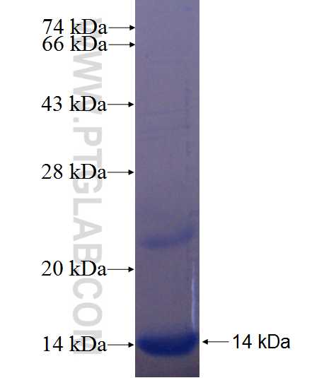 SLC25A17 fusion protein Ag24456 SDS-PAGE