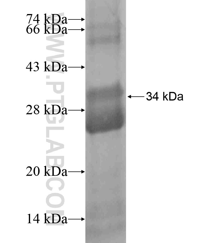 SLC25A17 fusion protein Ag18118 SDS-PAGE