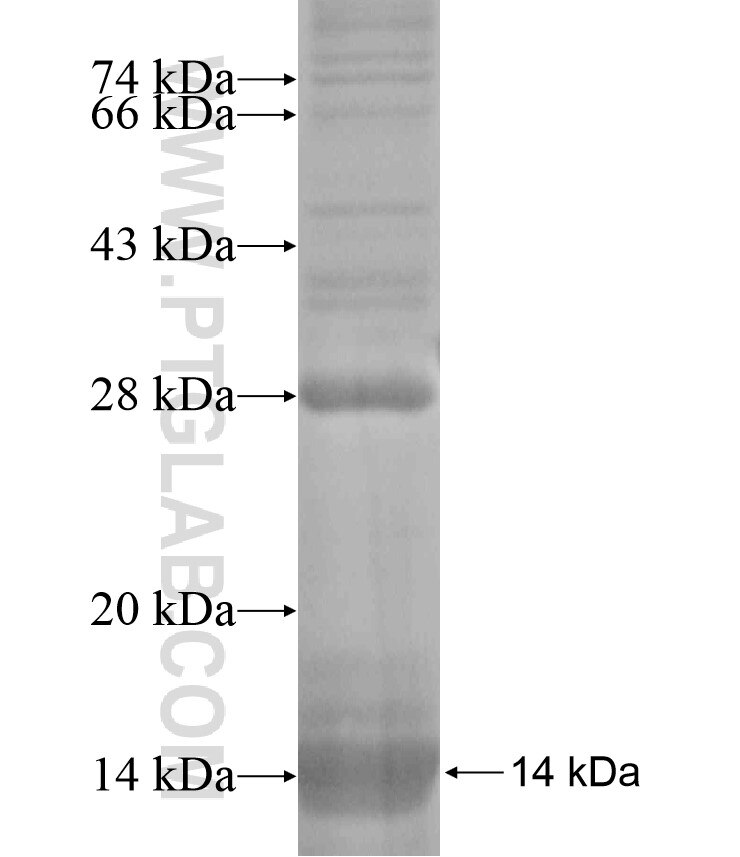 SLC25A17 fusion protein Ag18171 SDS-PAGE