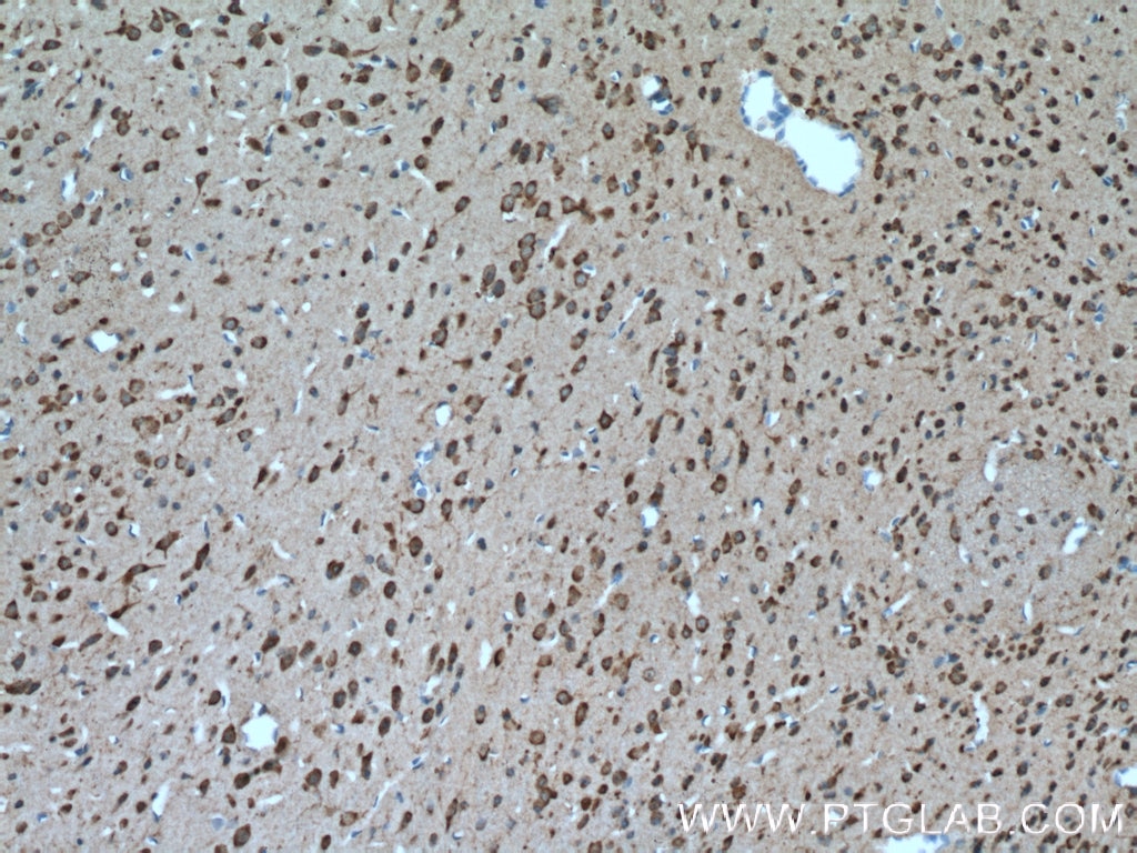 Immunohistochemistry (IHC) staining of mouse brain tissue using SLC25A18 Polyclonal antibody (17348-1-AP)