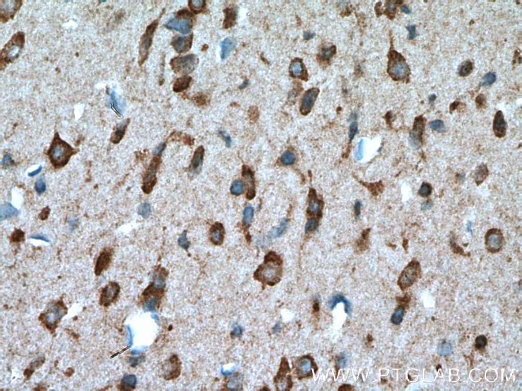 Immunohistochemistry (IHC) staining of mouse brain tissue using SLC25A18 Polyclonal antibody (17348-1-AP)