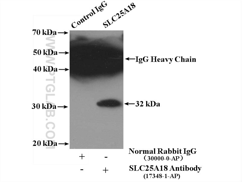 Immunoprecipitation (IP) experiment of mouse brain tissue using SLC25A18 Polyclonal antibody (17348-1-AP)