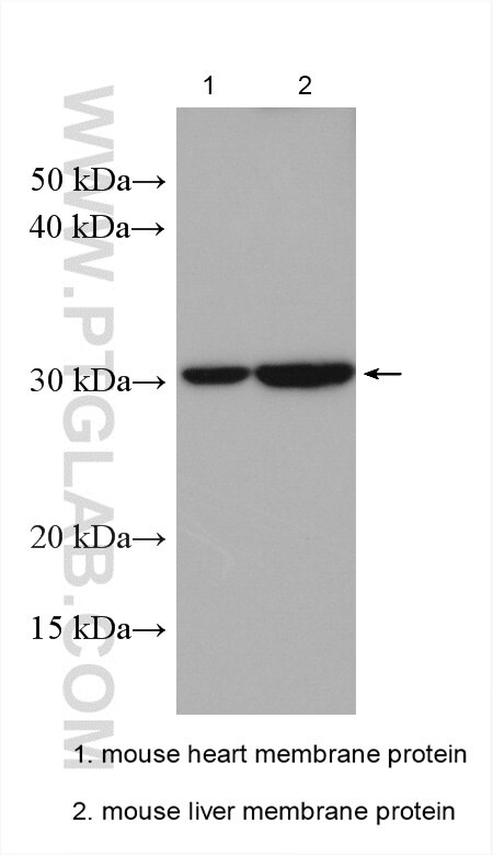 Western Blot (WB) analysis of various lysates using SLC25A18 Polyclonal antibody (17348-1-AP)