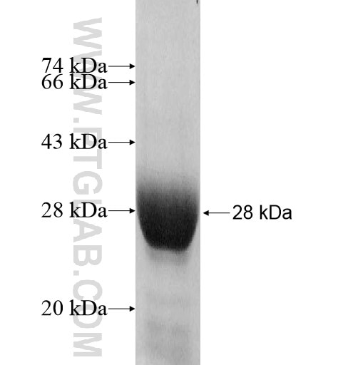 SLC25A18 fusion protein Ag11397 SDS-PAGE