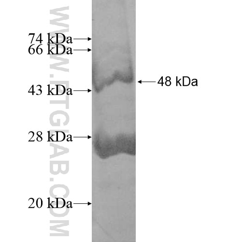 SLC25A18 fusion protein Ag11420 SDS-PAGE