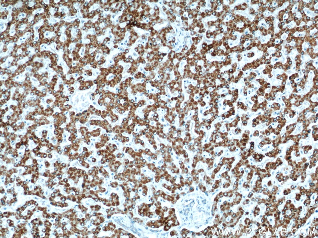 Immunohistochemistry (IHC) staining of human liver tissue using SLC25A2 Polyclonal antibody (21764-1-AP)