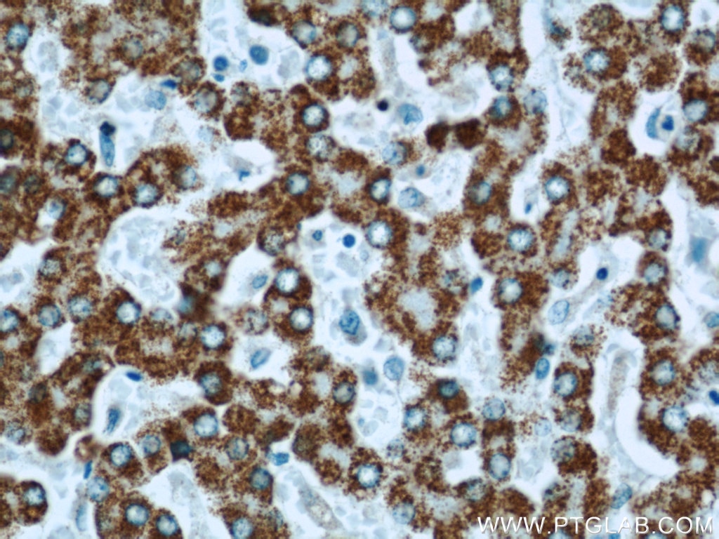 Immunohistochemistry (IHC) staining of human liver tissue using SLC25A2 Polyclonal antibody (21764-1-AP)