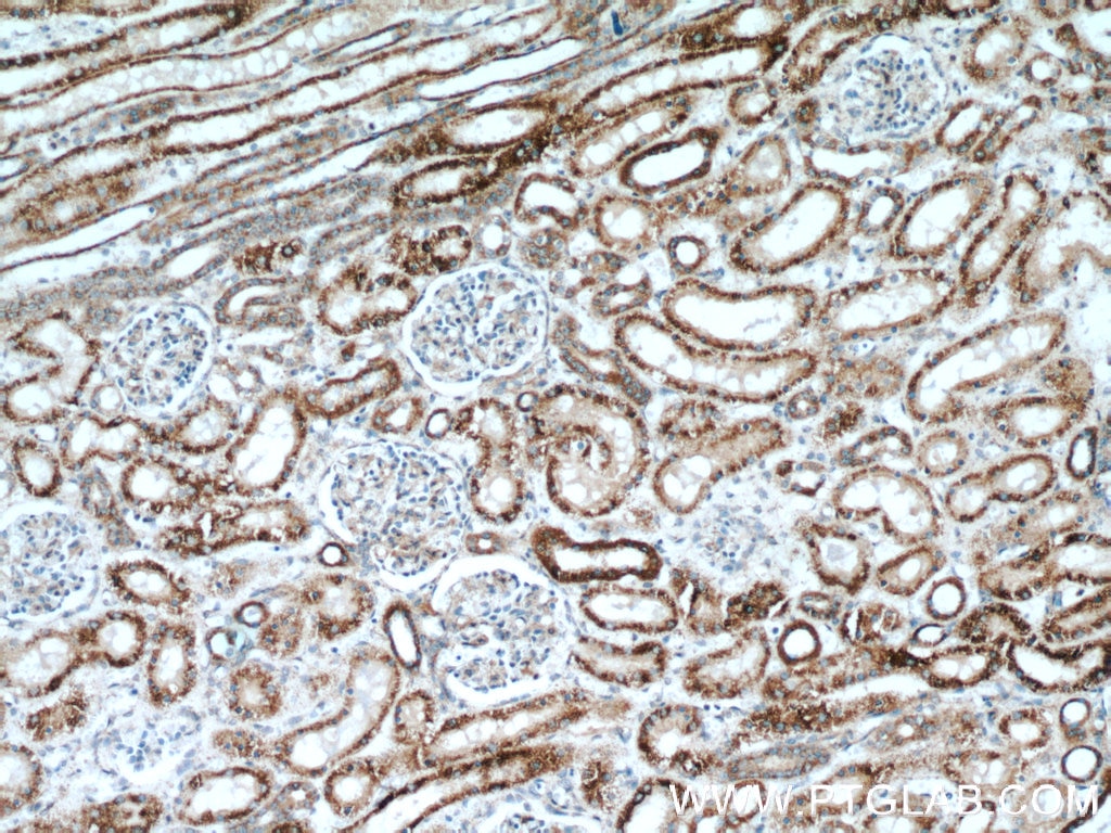 Immunohistochemistry (IHC) staining of human kidney tissue using SLC25A2 Polyclonal antibody (21764-1-AP)
