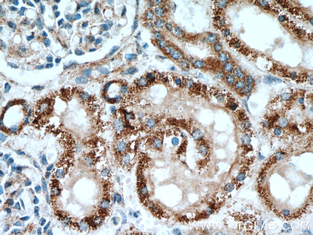 Immunohistochemistry (IHC) staining of human kidney tissue using SLC25A2 Polyclonal antibody (21764-1-AP)