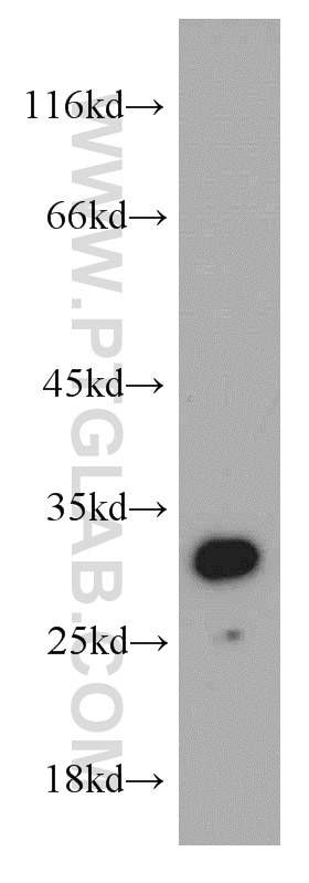 Western Blot (WB) analysis of mouse liver tissue using SLC25A2 Polyclonal antibody (21764-1-AP)