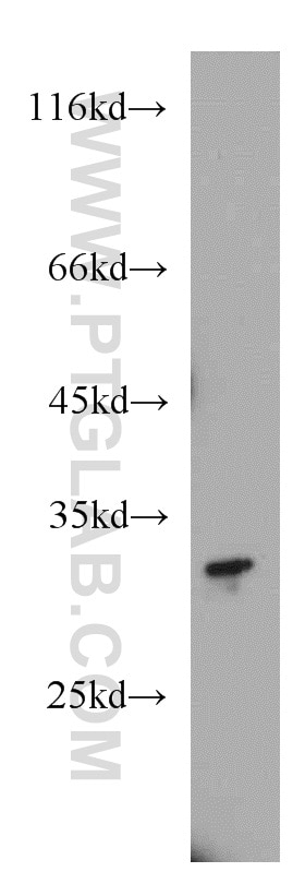 Western Blot (WB) analysis of HeLa cells using SLC25A2 Polyclonal antibody (21764-1-AP)