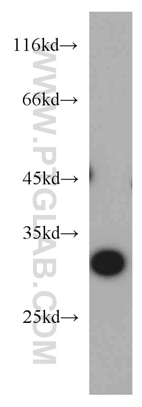 Western Blot (WB) analysis of mouse kidney tissue using SLC25A2 Polyclonal antibody (21764-1-AP)