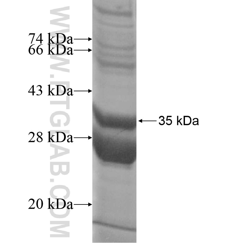 SLC25A2 fusion protein Ag16360 SDS-PAGE