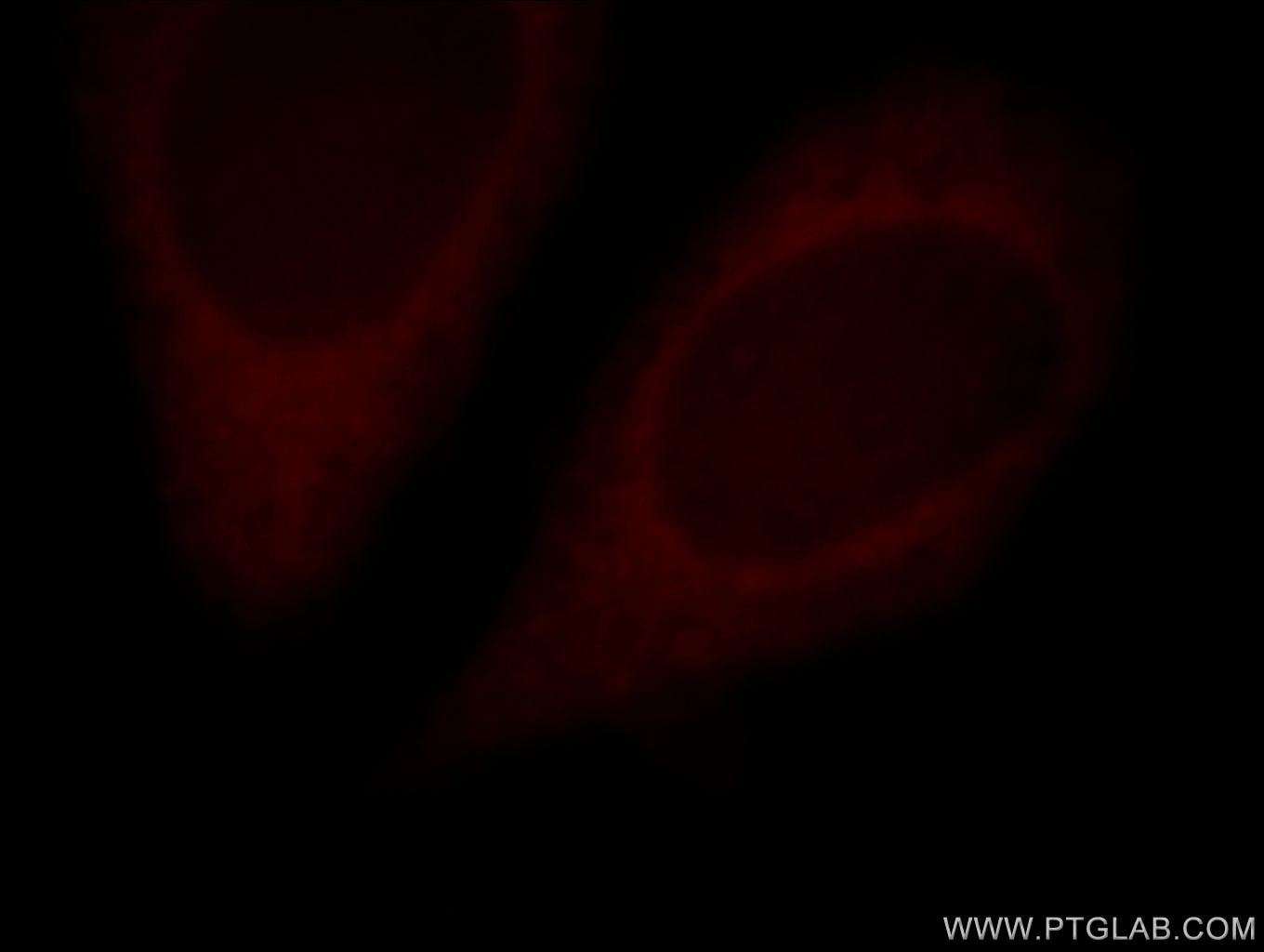 Immunofluorescence (IF) / fluorescent staining of HeLa cells using SLC25A20 Polyclonal antibody (19363-1-AP)