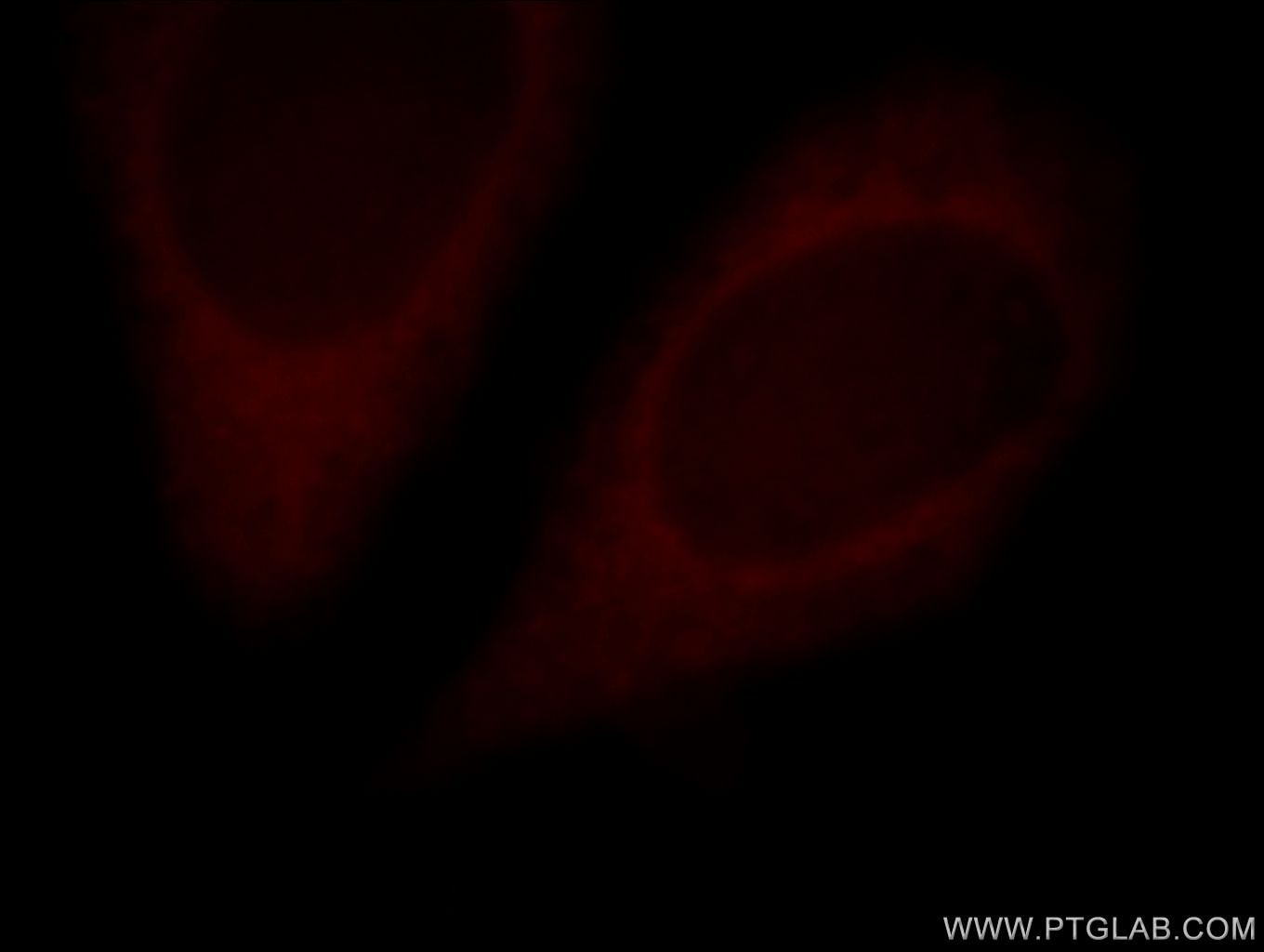 IF Staining of HeLa using 19363-1-AP