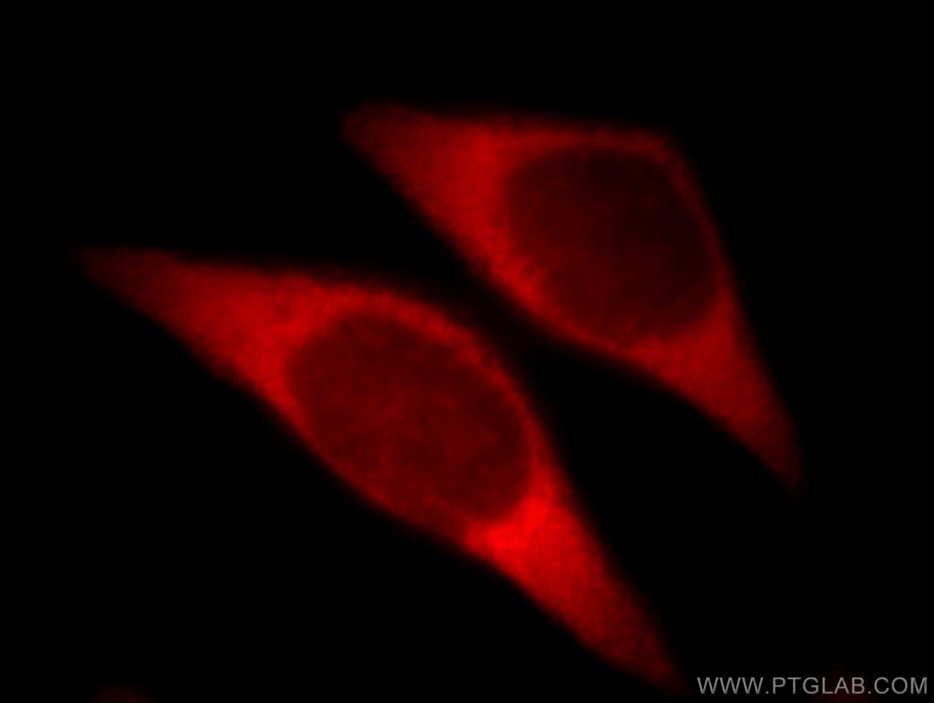 Immunofluorescence (IF) / fluorescent staining of MCF-7 cells using SLC25A20 Polyclonal antibody (19363-1-AP)