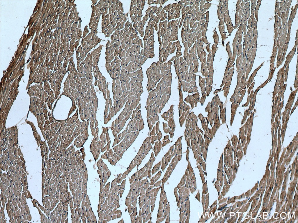 Immunohistochemistry (IHC) staining of mouse heart tissue using SLC25A20 Polyclonal antibody (19363-1-AP)