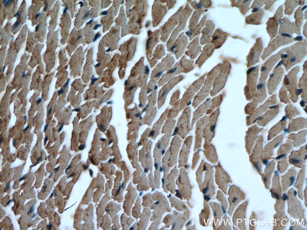 Immunohistochemistry (IHC) staining of mouse heart tissue using SLC25A20 Polyclonal antibody (19363-1-AP)
