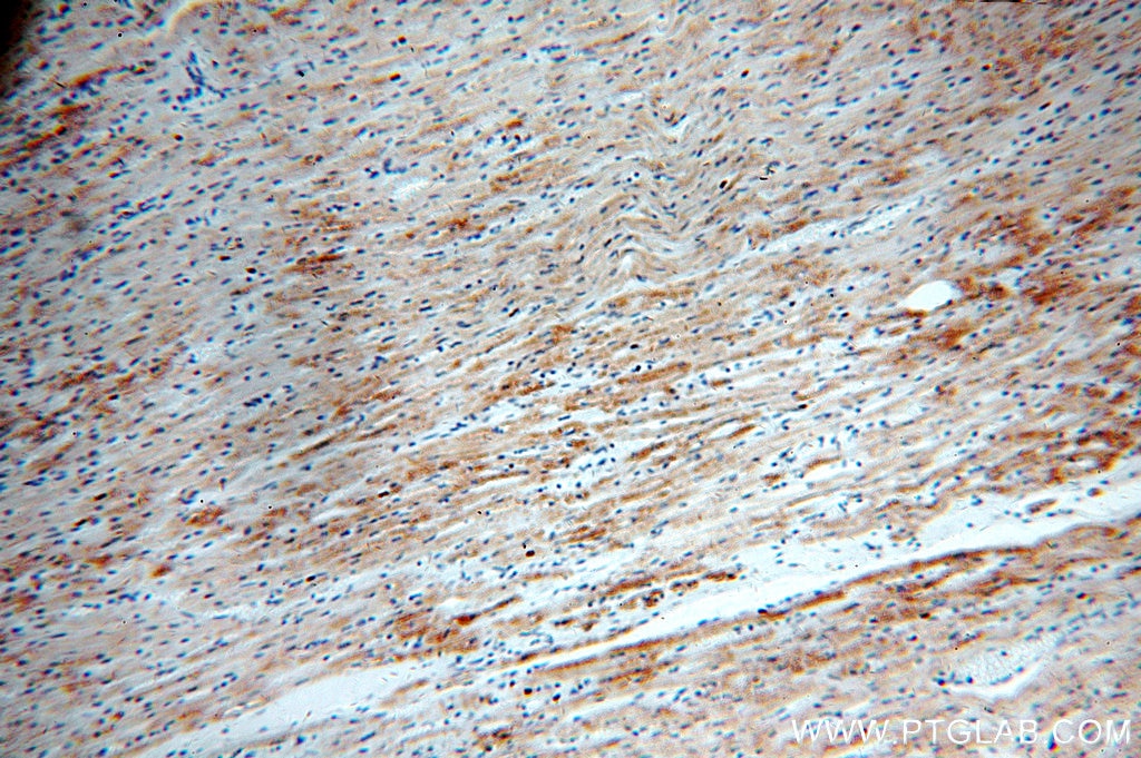 Immunohistochemistry (IHC) staining of human heart tissue using SLC25A20 Polyclonal antibody (19363-1-AP)