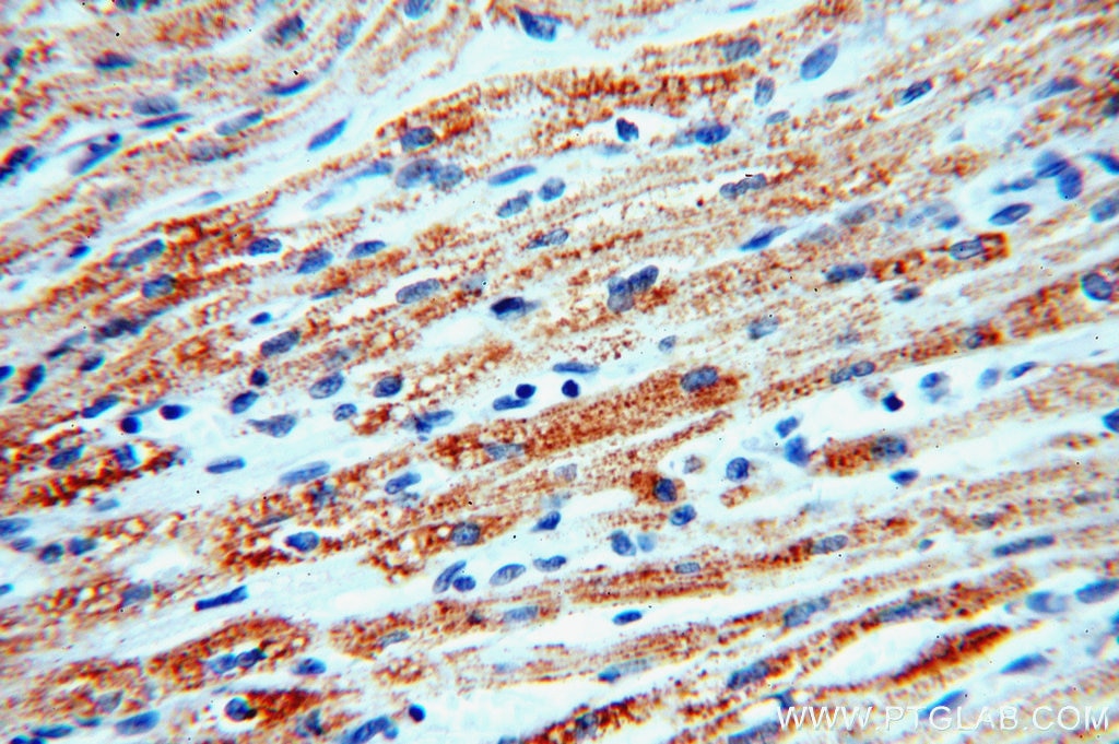 IHC staining of human heart using 19363-1-AP