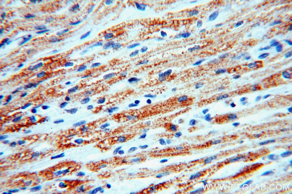 Immunohistochemistry (IHC) staining of human heart tissue using SLC25A20 Polyclonal antibody (19363-1-AP)