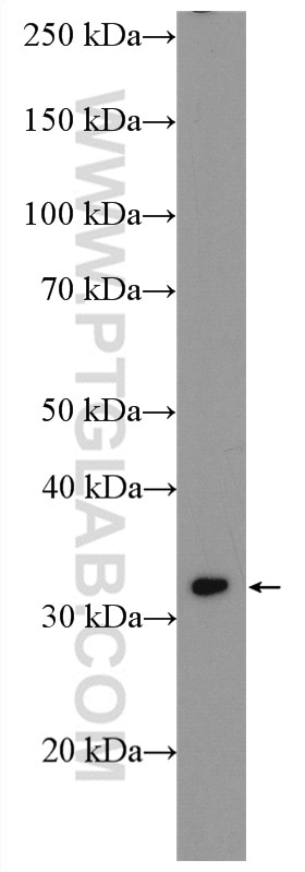 Western Blot (WB) analysis of mouse heart tissue using SLC25A20 Polyclonal antibody (19363-1-AP)