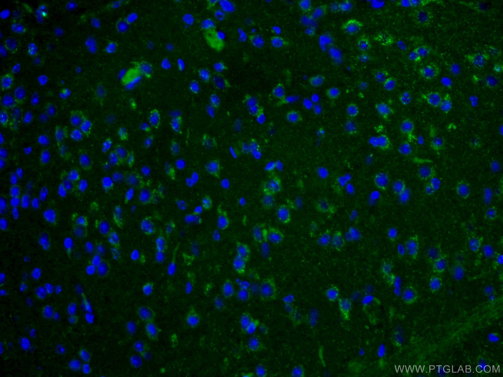 Immunofluorescence (IF) / fluorescent staining of mouse brain tissue using SLC25A22 Polyclonal antibody (25402-1-AP)