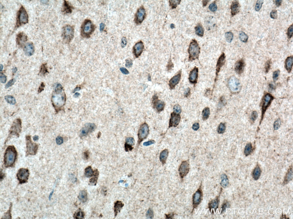 Immunohistochemistry (IHC) staining of mouse brain tissue using SLC25A22 Polyclonal antibody (25402-1-AP)