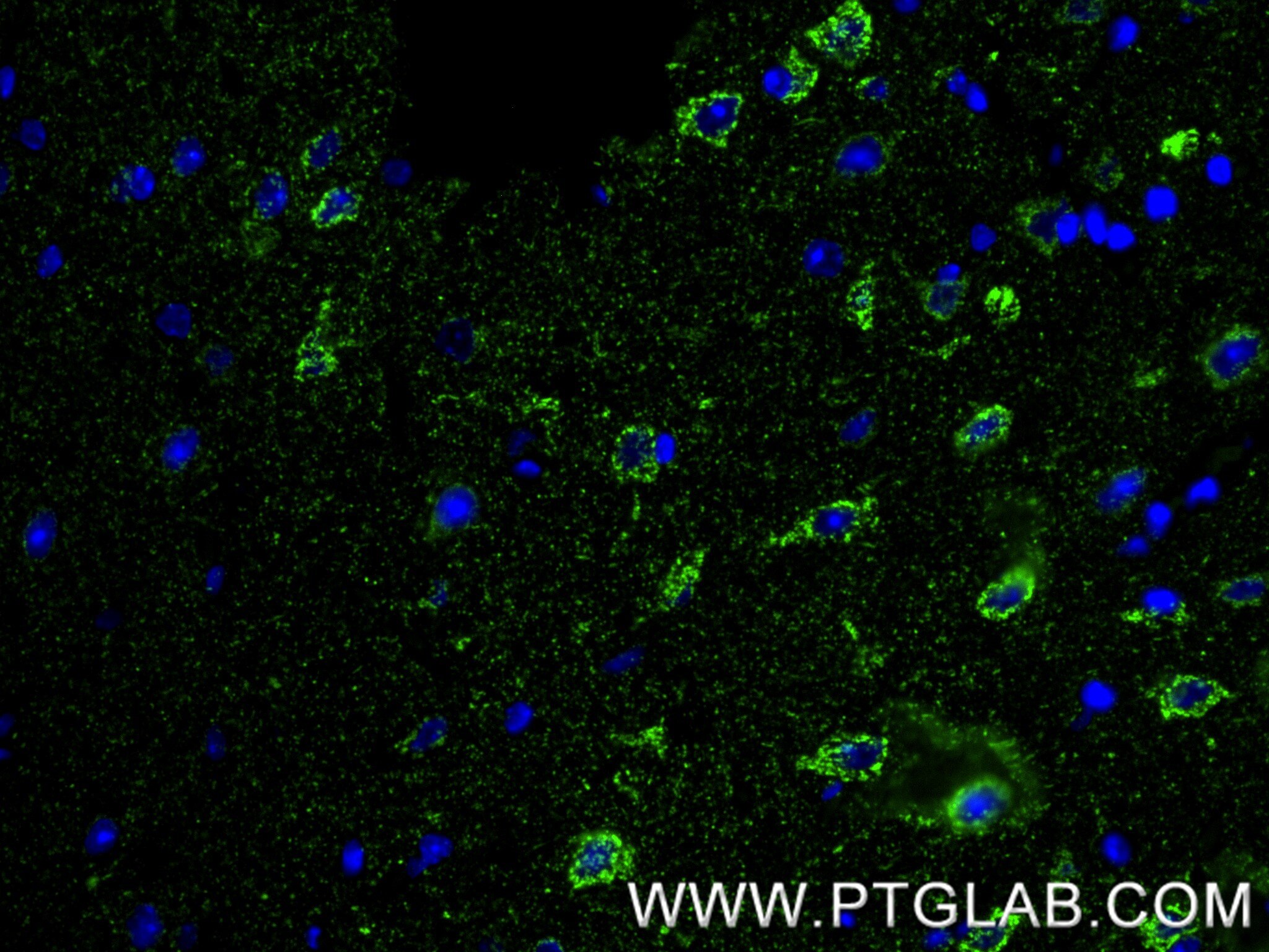 Immunofluorescent analysis of (4% PFA) fixed paraffin-embedded mouse brain tissue using SLC25A22 antibody (86163-1-RR, Clone: 250788B11 ) at dilution of 1:250 and CoraLite®488-Conjugated Goat Anti-Rabbit IgG(H+L) (SA00013-2). Heat mediated antigen retrieval with Tris-EDTA buffer (pH 9.0). Immunofluorescence (IF) / fluorescent staining of mouse brain tissue using SLC25A22 Recombinant monoclonal antibody (86163-1-RR)