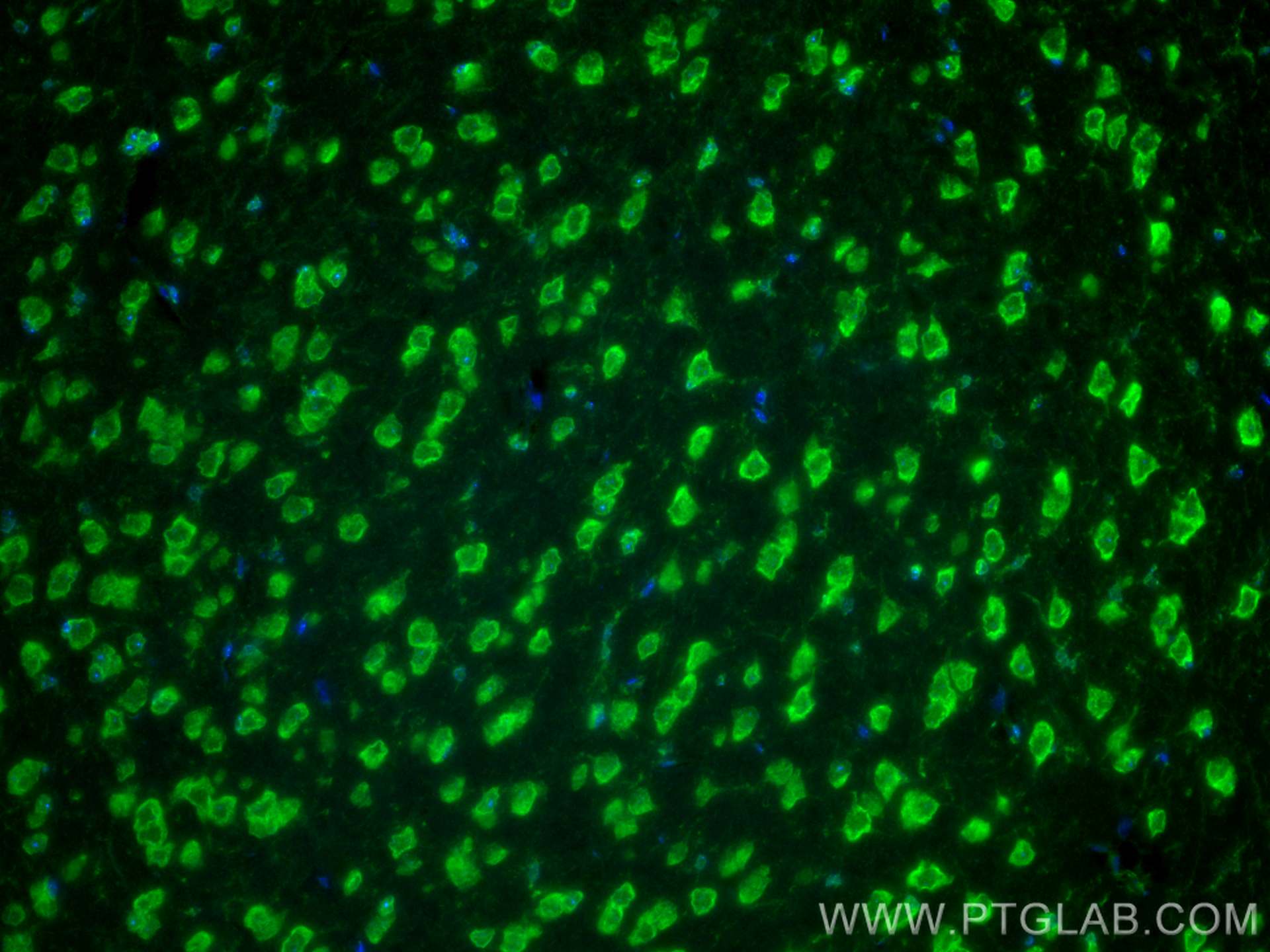 Immunofluorescence (IF) / fluorescent staining of mouse brain tissue using CoraLite® Plus 488-conjugated SLC25A22 Polyclonal  (CL488-25402)