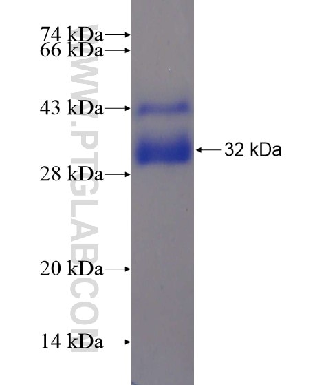 SLC25A22 fusion protein Ag19958 SDS-PAGE