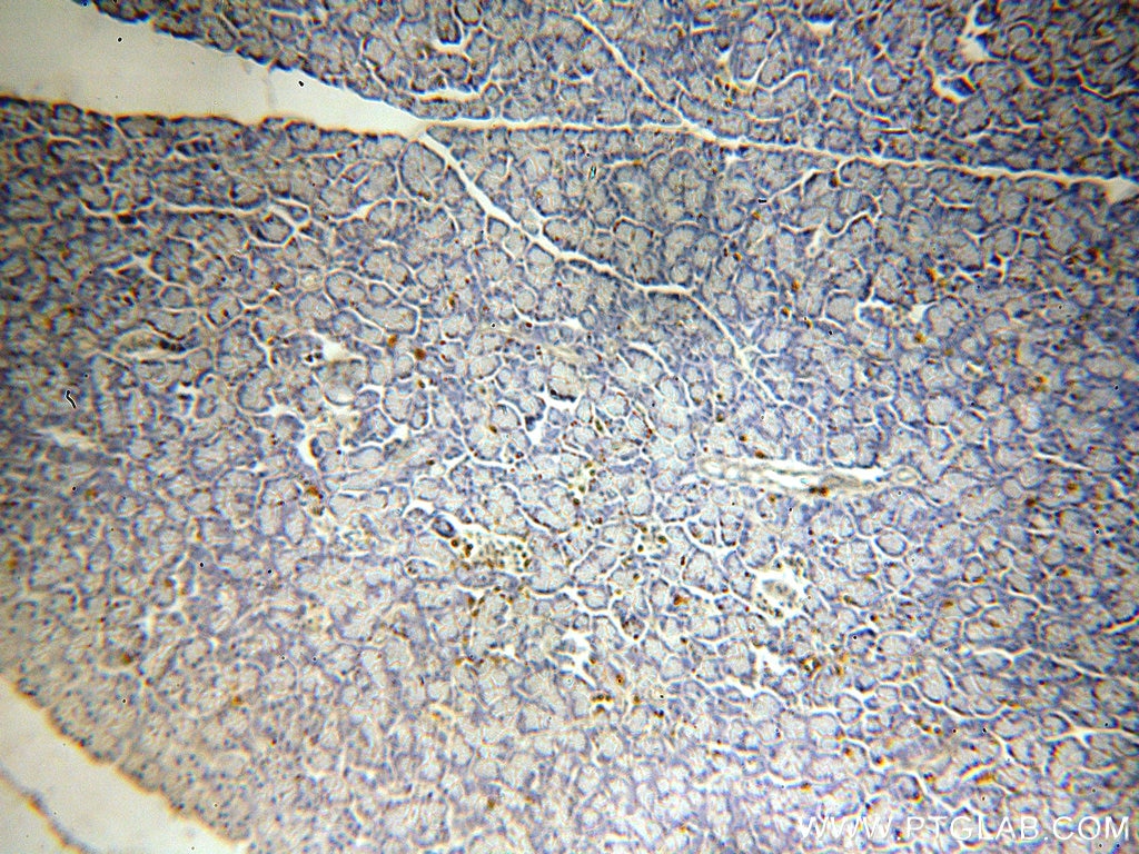 Immunohistochemistry (IHC) staining of human pancreas tissue using SLC25A23 Polyclonal antibody (20168-1-AP)