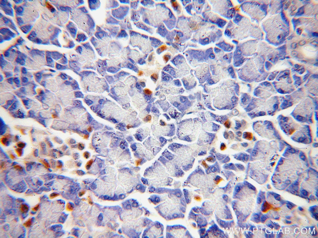 Immunohistochemistry (IHC) staining of human pancreas tissue using SLC25A23 Polyclonal antibody (20168-1-AP)