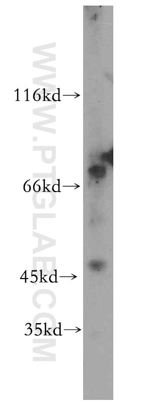 Western Blot (WB) analysis of mouse skeletal muscle tissue using SLC25A23 Polyclonal antibody (20168-1-AP)