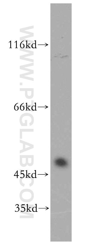 Western Blot (WB) analysis of SH-SY5Y cells using SLC25A23 Polyclonal antibody (20168-1-AP)