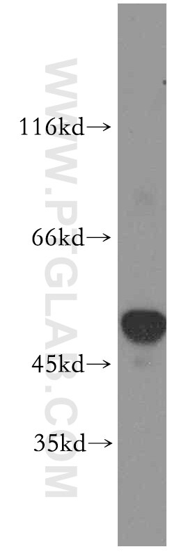 Western Blot (WB) analysis of mouse pancreas tissue using SLC25A23 Polyclonal antibody (20168-1-AP)