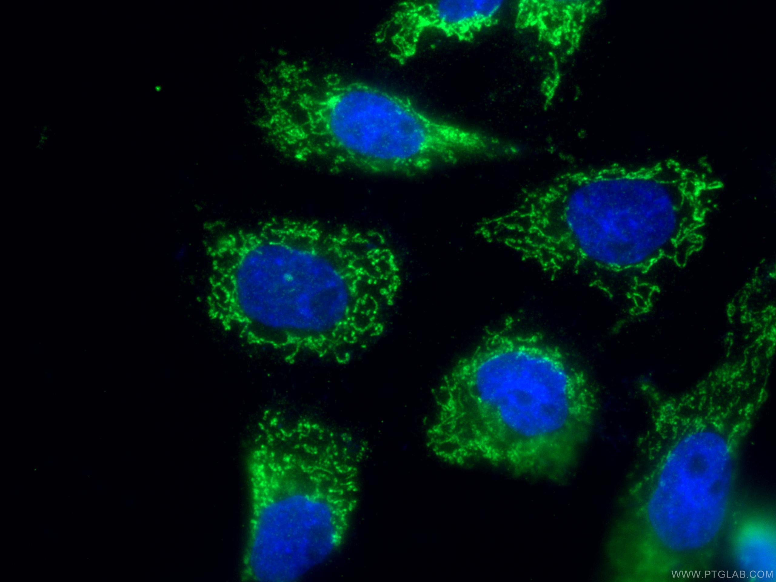 Immunofluorescence (IF) / fluorescent staining of A431 cells using SLC25A24 Polyclonal antibody (14669-1-AP)