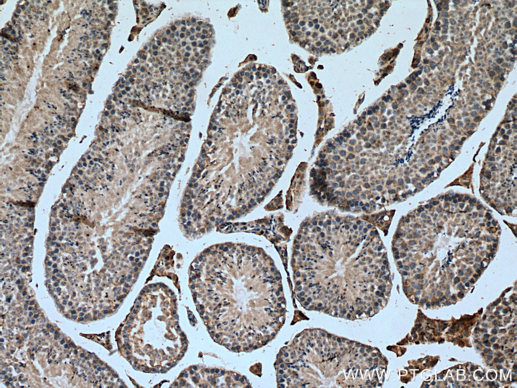 Immunohistochemistry (IHC) staining of mouse testis tissue using SLC25A24 Polyclonal antibody (14669-1-AP)
