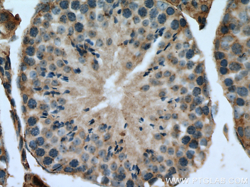 IHC staining of mouse testis using 14669-1-AP