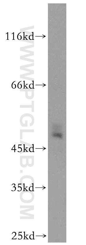 Western Blot (WB) analysis of mouse heart tissue using SLC25A24 Polyclonal antibody (14669-1-AP)