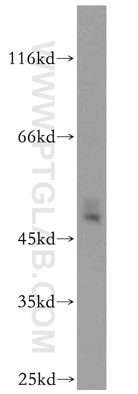 WB analysis of mouse heart using 14669-1-AP