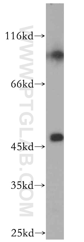 Western Blot (WB) analysis of human placenta tissue using SLC25A24 Polyclonal antibody (14669-1-AP)