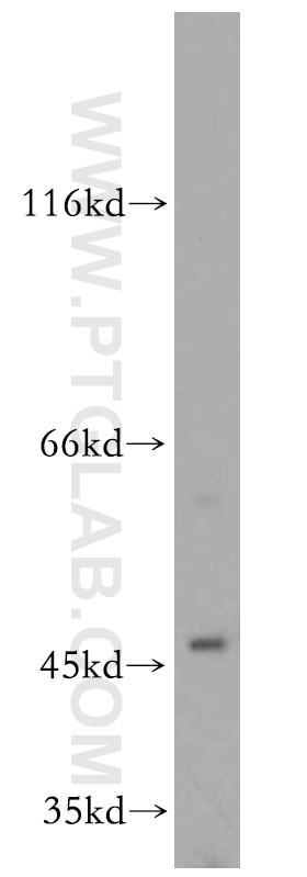 Western Blot (WB) analysis of HEK-293 cells using SLC25A24 Polyclonal antibody (14669-1-AP)