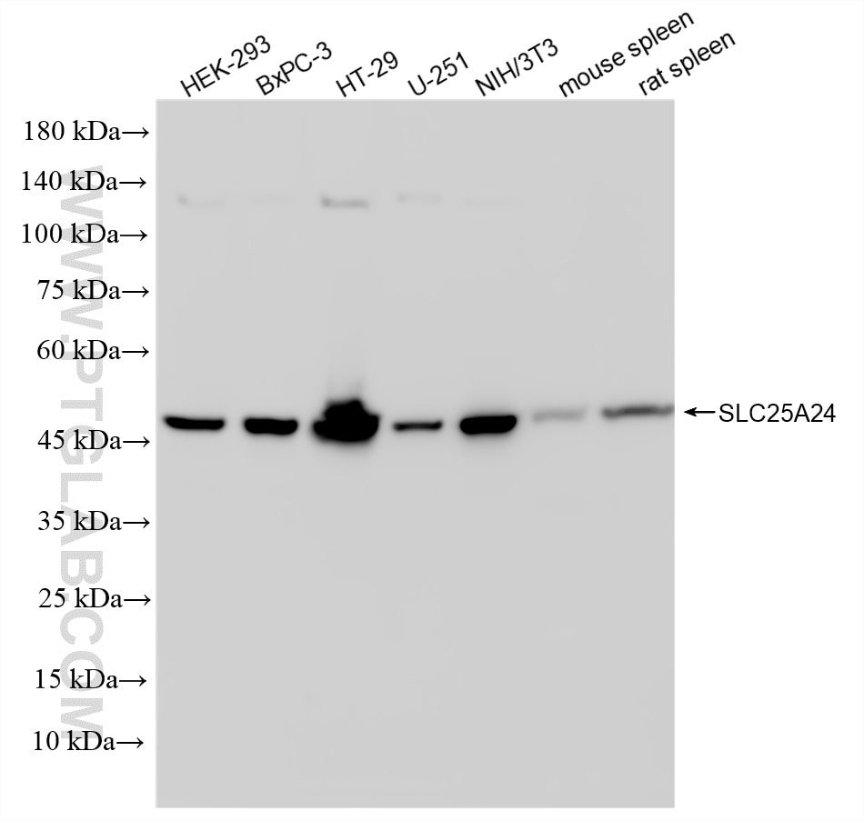 WB analysis using 86635-1-RR Western Blot (WB) analysis of various lysates using SLC25A24 Recombinant monoclonal antibody (86635-1-RR)