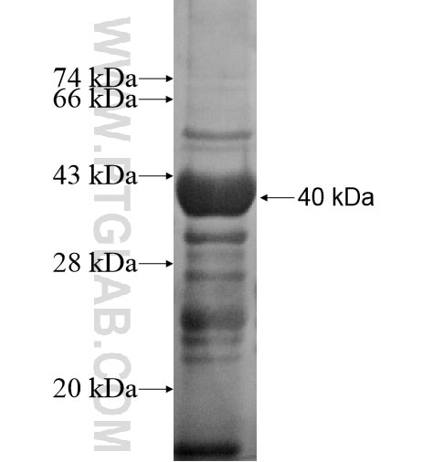 SLC25A24 fusion protein Ag14623 SDS-PAGE