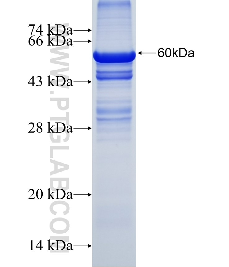 SLC25A24 fusion protein Ag6334 SDS-PAGE