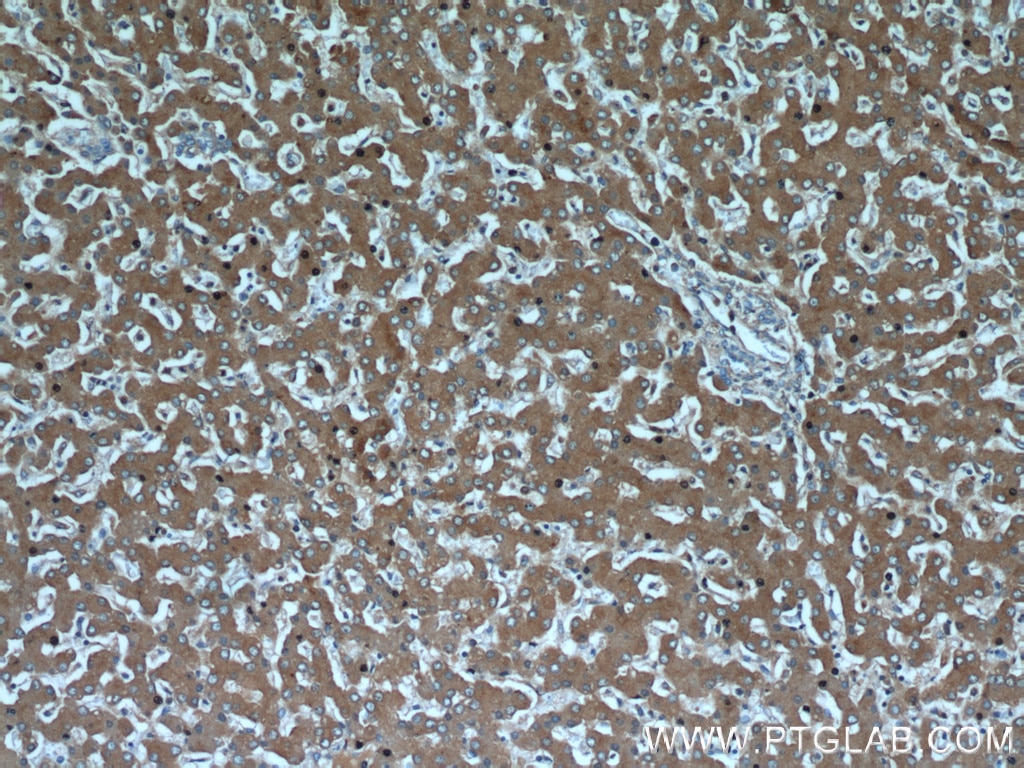 Immunohistochemistry (IHC) staining of human liver tissue using SLC25A25 Polyclonal antibody (21568-1-AP)