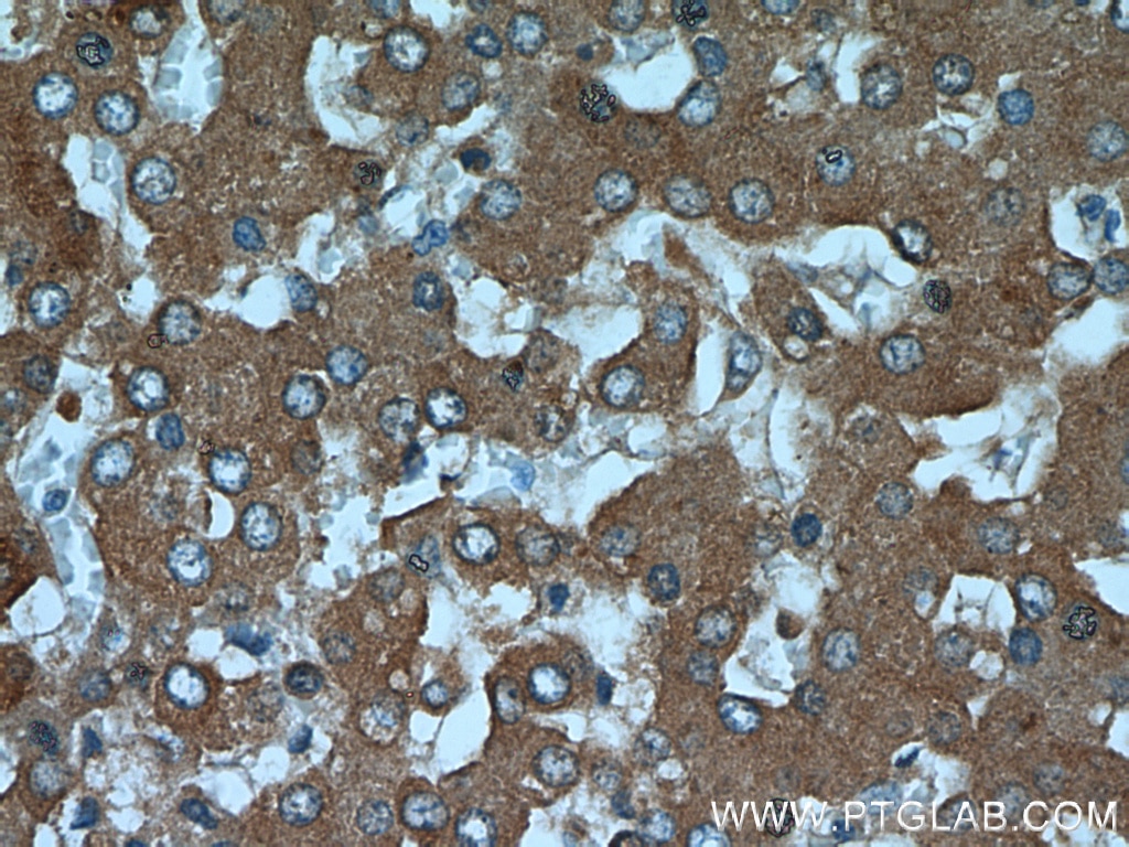 Immunohistochemistry (IHC) staining of human liver tissue using SLC25A25 Polyclonal antibody (21568-1-AP)