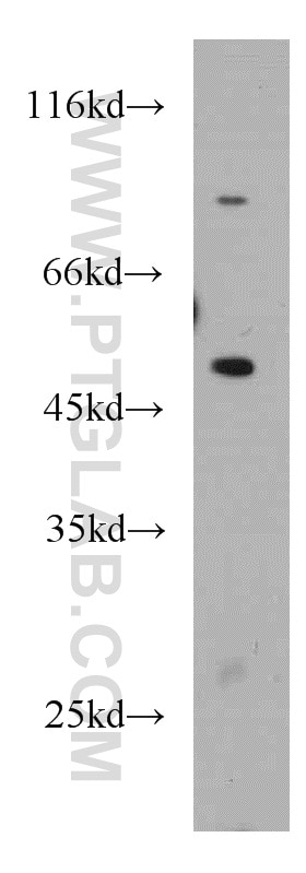 Western Blot (WB) analysis of RAW264.7 using SLC25A25 Polyclonal antibody (21568-1-AP)